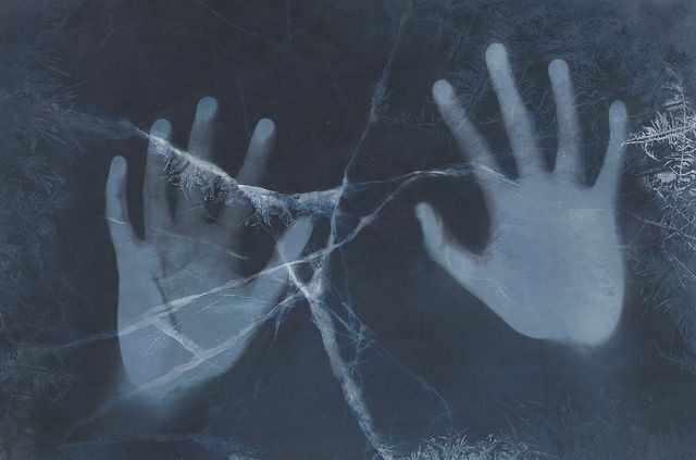 Frostbite